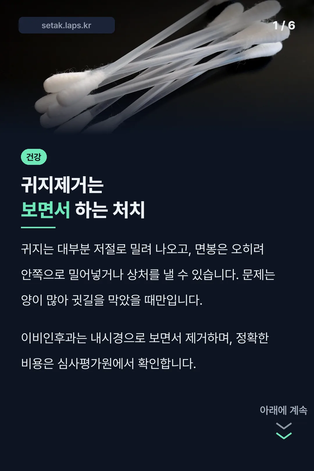 귀지제거는 보면서 하는 처치