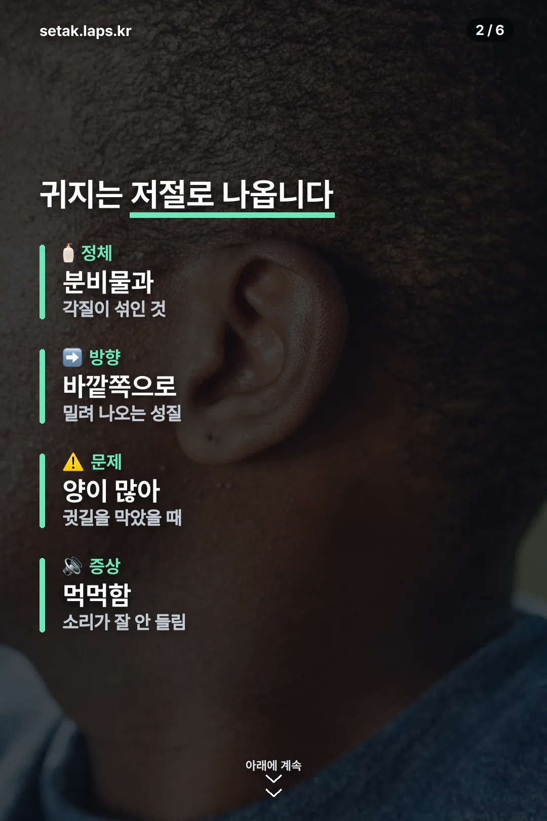 귀지 기본 정리