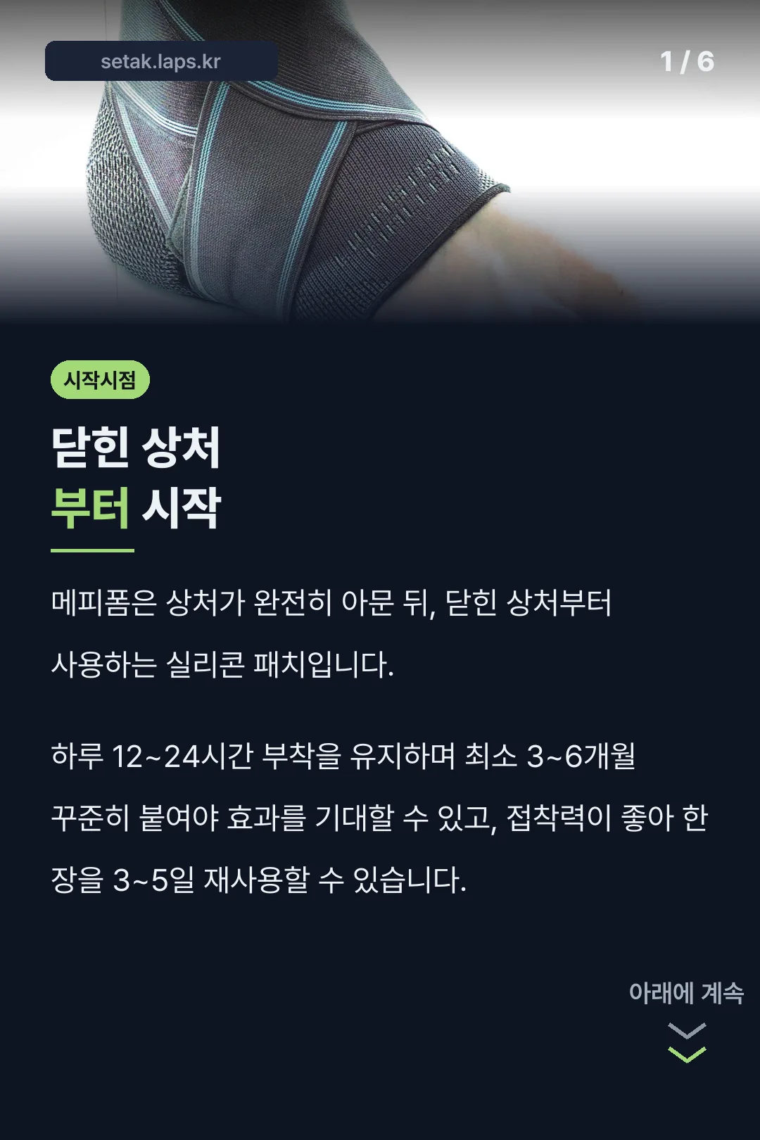 닫힌 상처부터 시작