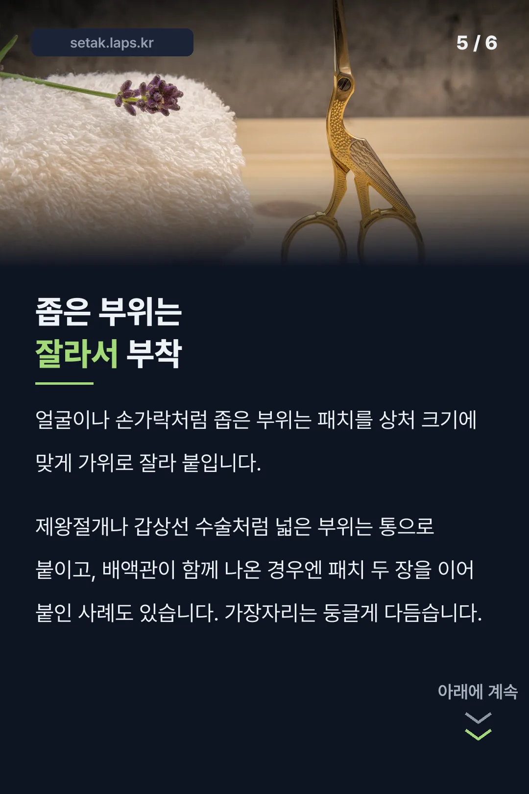 좁은 부위 부착법